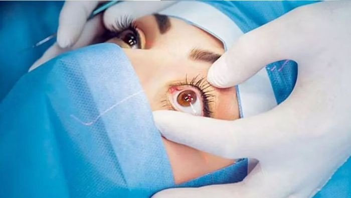 Best Cataract Hospital in Ambala: Kapil Eye Hospital