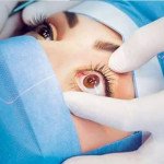 Best Cataract Hospital in Ambala: Kapil Eye Hospital