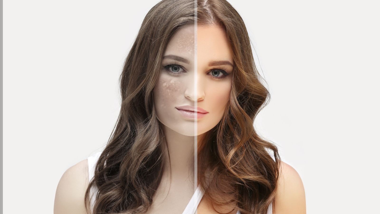 Skin care • Hyperpigmentation