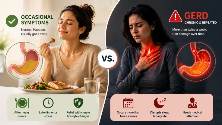 Occasional symptoms vs GERD comparison
