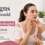 7 Signs You Should See a Dermatologist for Acne